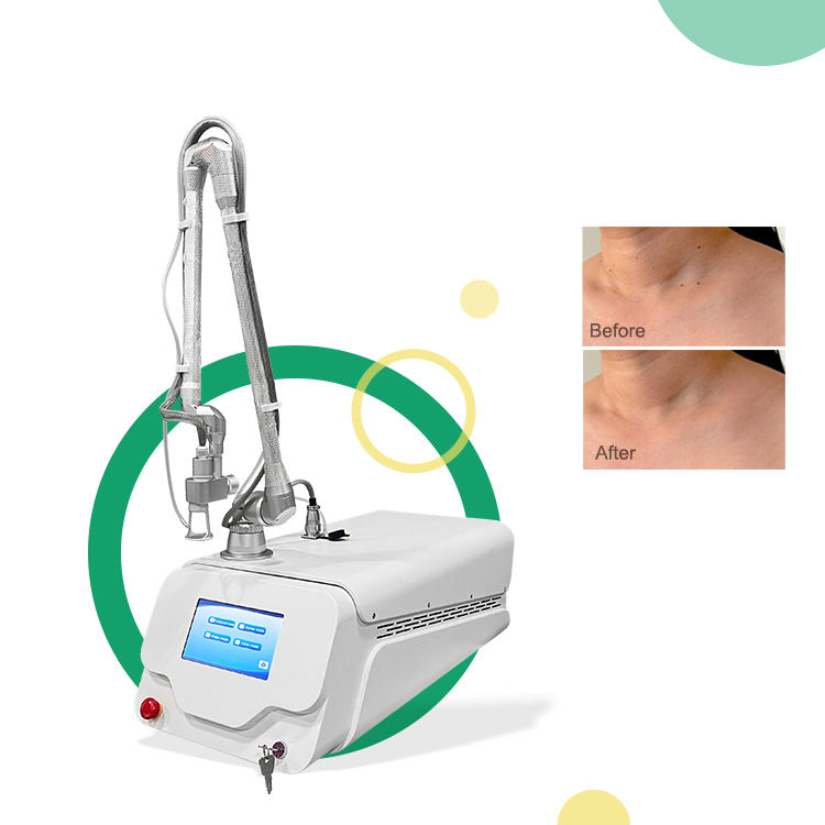 High Powerful Co2 Fractional Vaginal Tightening Laser Machine Skin Whitening Stretch Mark Removal Carbon Laser For Skin