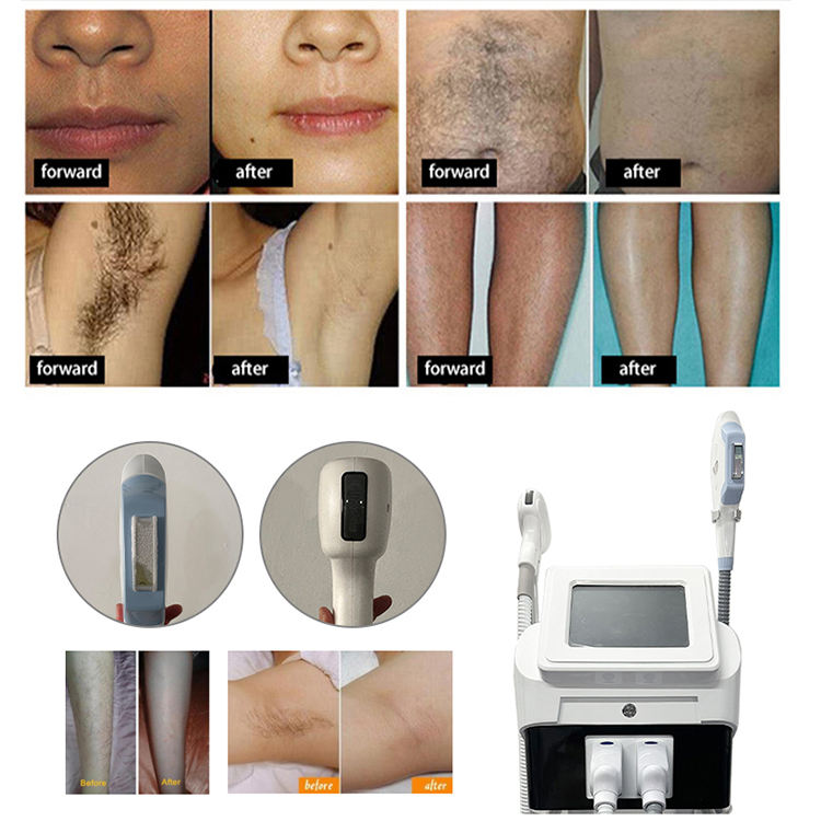 Machine IPL OPT 808nm Laser Skin Rejuvenation Laser Diode In Beauty Depilation Pigmentation Removal Freckles Remove Skin Vascular Removal
