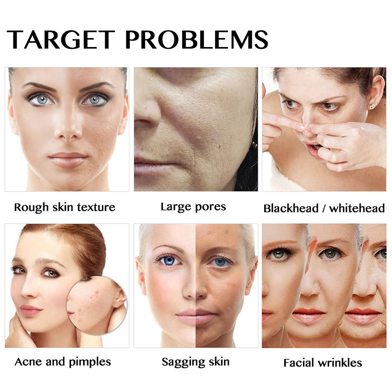 6 In 1 Beauty Dermabrasion Water Microdermabrasion Peeling Beauty Cleansing H2o2 Oxygen Beauty Machine