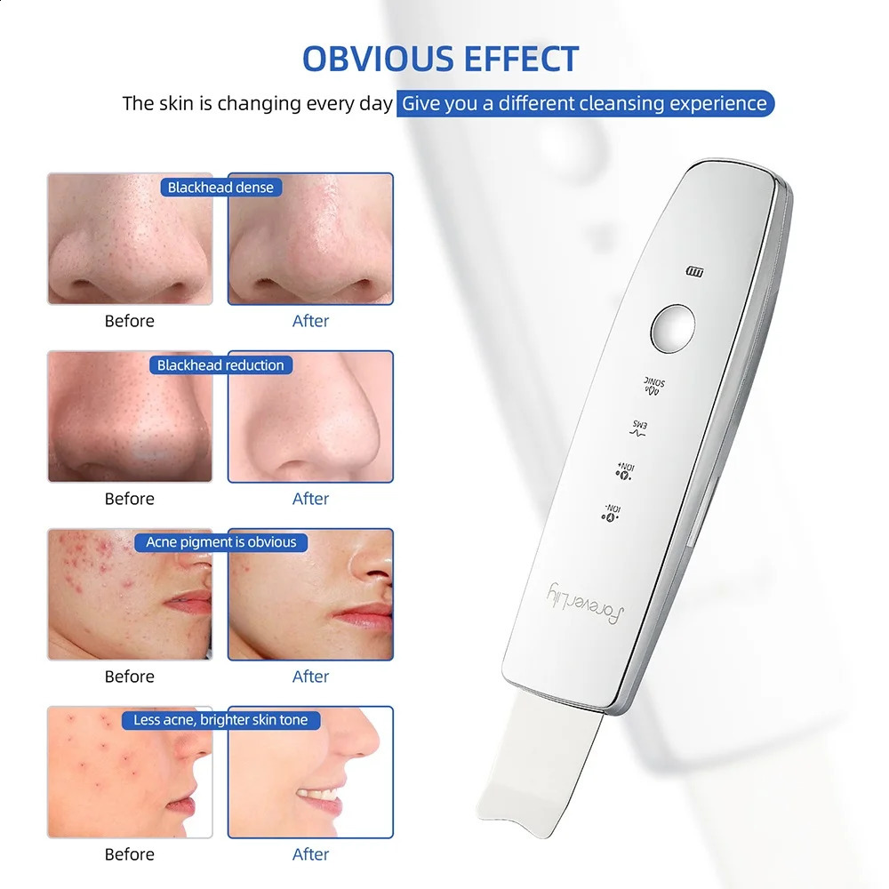 6 in 1 EMS Ultrasonic Skin Scrubber ION LED Pon Skin Lifting Massager Face Spatula Blackhead Remover Deep Cleansing 240718