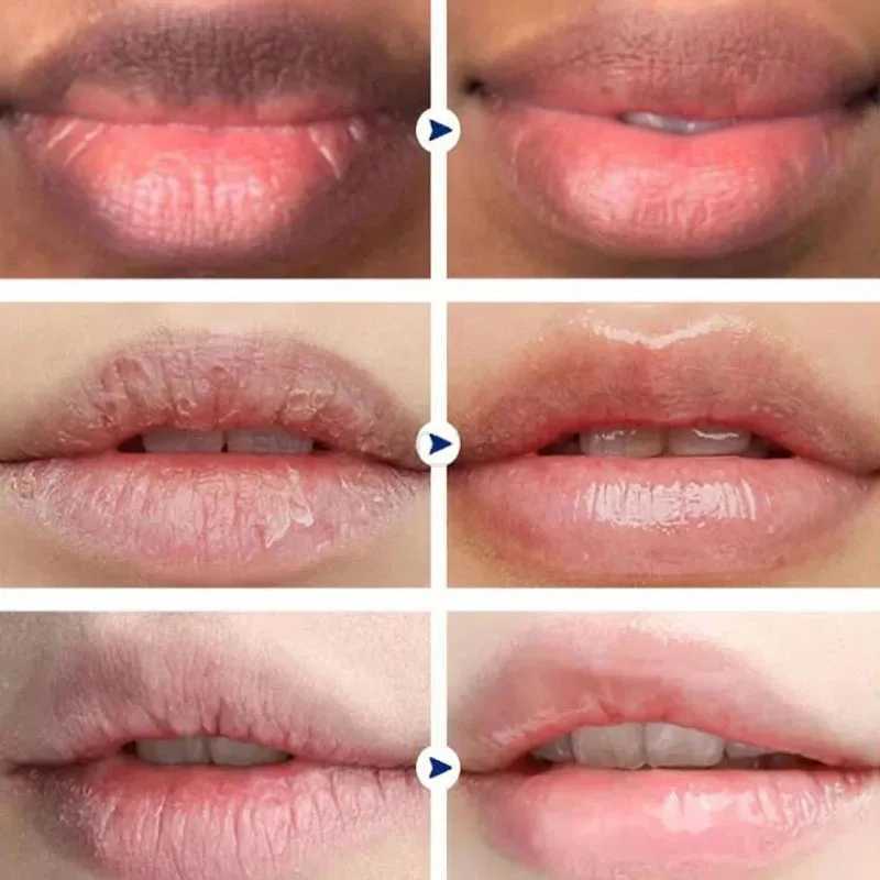 Instantly Lip Balm Remove Dark Lighten Melanin Lip Mask Fade Lip Line Brighten Exfoliating Moisturize Dead Skin Repair Lip CareXJ240812