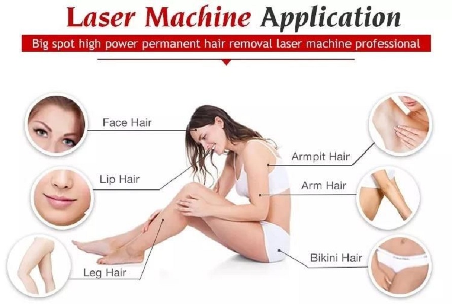 Hot ice diode Laser 755 808 1064nm Platinum Titanium 808nm hair removal alexandrite Laser Hair Removal Machine