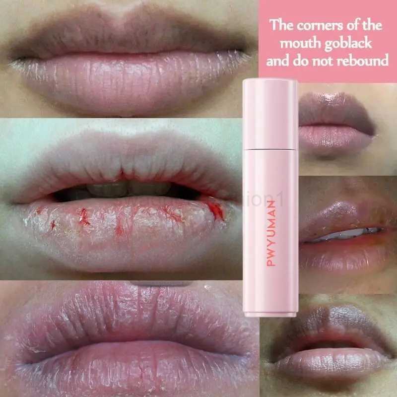 Remove Dark Lip Balm Moisturizing Lighten Melanin Bleaching Lip Gloss Lip Pink Lipstick Exfoliating Fade Lip Line Beauty HealthXJ240812