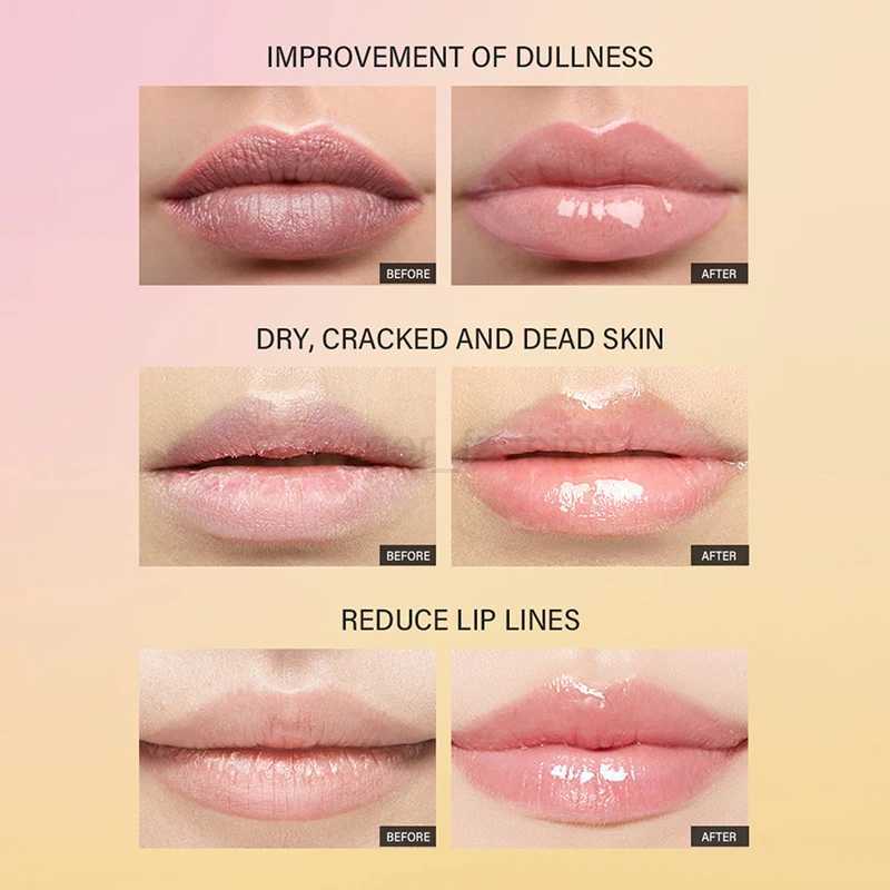 Lip Treatment Moisturizing And Repairing Peptide Lip Mask Gel Remove Dead Skin Lip Balm Base Lip Care Cream Beauty Health 10mlXJ240812
