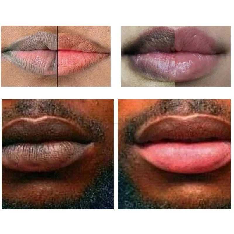 Remove Dark Lip Balm Lightening Melanin Mask Gloss Oil Exfoliating Clean Moisturizer Korean Care Products Makeup Beauty HealthXJ240812