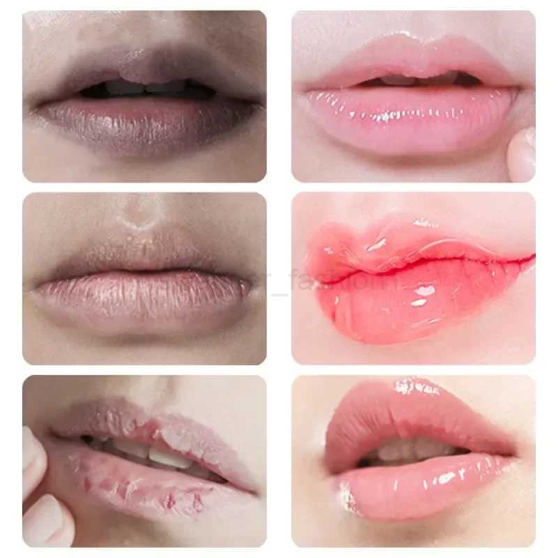 Remove Dark Lip Balm Lightening Melanin Mask Gloss Oil Exfoliating Clean Moisturizer Korean Care Products Beauty Health MakeupXJ240812