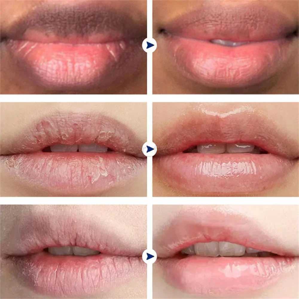 Remove Dark Smoke Lip Balm Lightening Melanin Bleaching Gloss Oil Lips Pink Lipstick Exfoliating Fade Lip Lines Korean CosmeticsXJ240812