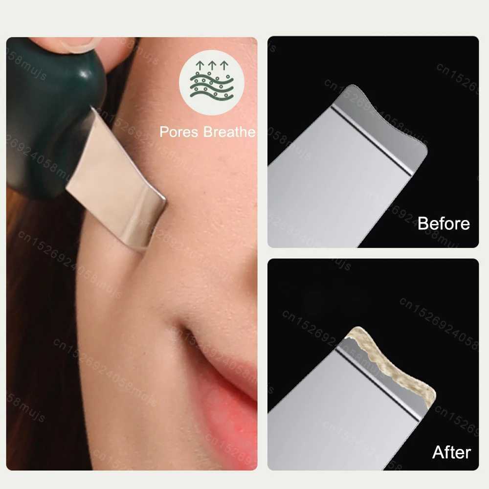 Skin Scrubber Blackhead Removal Portable Facial Massage Cleaner Acne Blackhead Remover Peeling Cleaner Facial Lifting Skin Mini CL240824