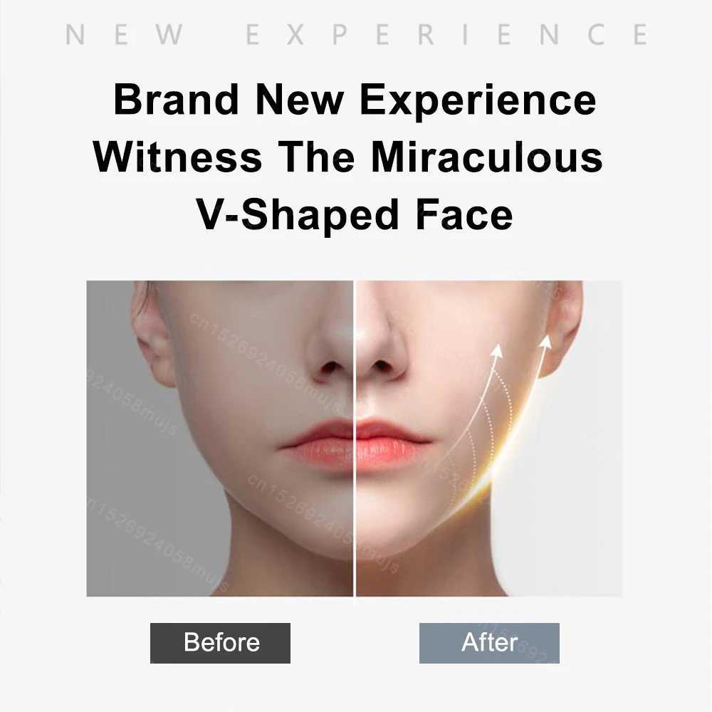Skin Scrubber Blackhead Removal Portable Facial Massage Cleaner Acne Blackhead Remover Peeling Cleaner Facial Lifting Skin Mini CL240824