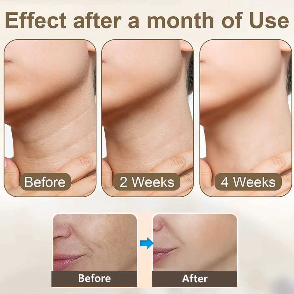 Face Lifting Massager Neck Face Lifting Machine Anti-aging Facial Massager Skin Tightening Anti-wrinkle Double Chin Remover CL240824