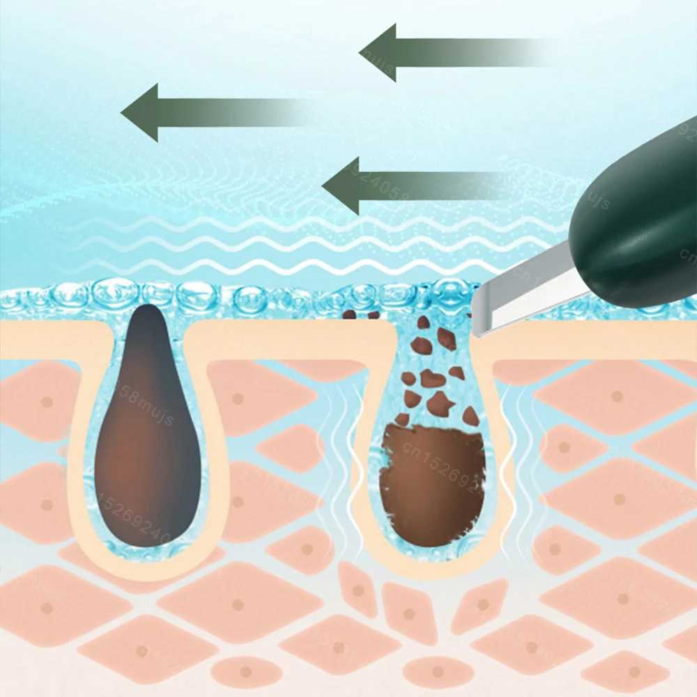 Skin Scrubber Blackhead Removal Portable Facial Massage Cleaner Acne Blackhead Remover Peeling Cleaner Facial Lifting Skin Mini CL240824