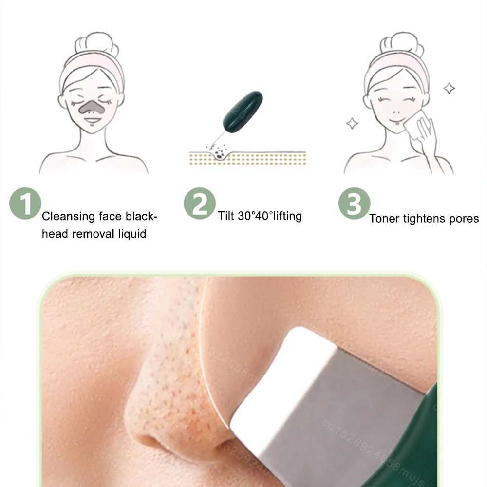 Skin Scrubber Blackhead Removal Portable Facial Massage Cleaner Acne Blackhead Remover Peeling Cleaner Facial Lifting Skin Mini CL240824