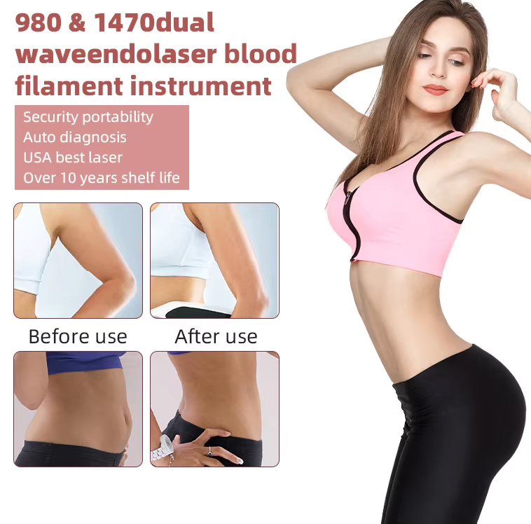 Advanced Diode Laser 2 Wavelength Body Contouring Fat Removal Lipolysis 980nm 1470nm Fiber-optic Coupled Lipolysis Diode Laser Body Slimming Machine