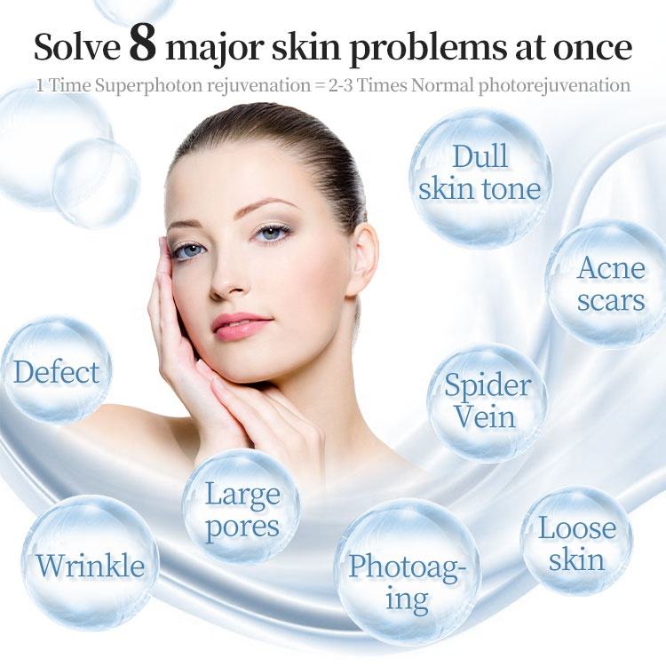 Dpl Opt Hair Removal Acne Removal Beauty Machine N-I-R S-R Ultra-photon Freckle Removal Skin Rejuvenation Device