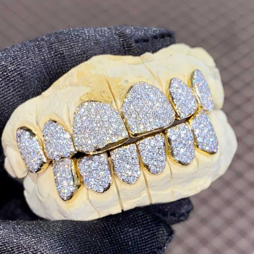 14k Diamond/Moissanite Dental Set Iced Out Hip Hop Bling Grills Teeth Grillz