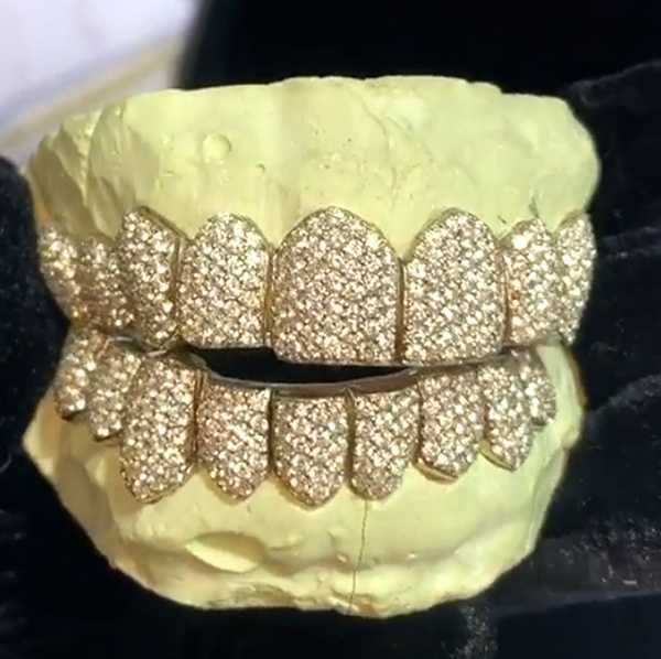 14k Diamond/Moissanite Dental Set Iced Out Hip Hop Bling Grills Teeth Grillz