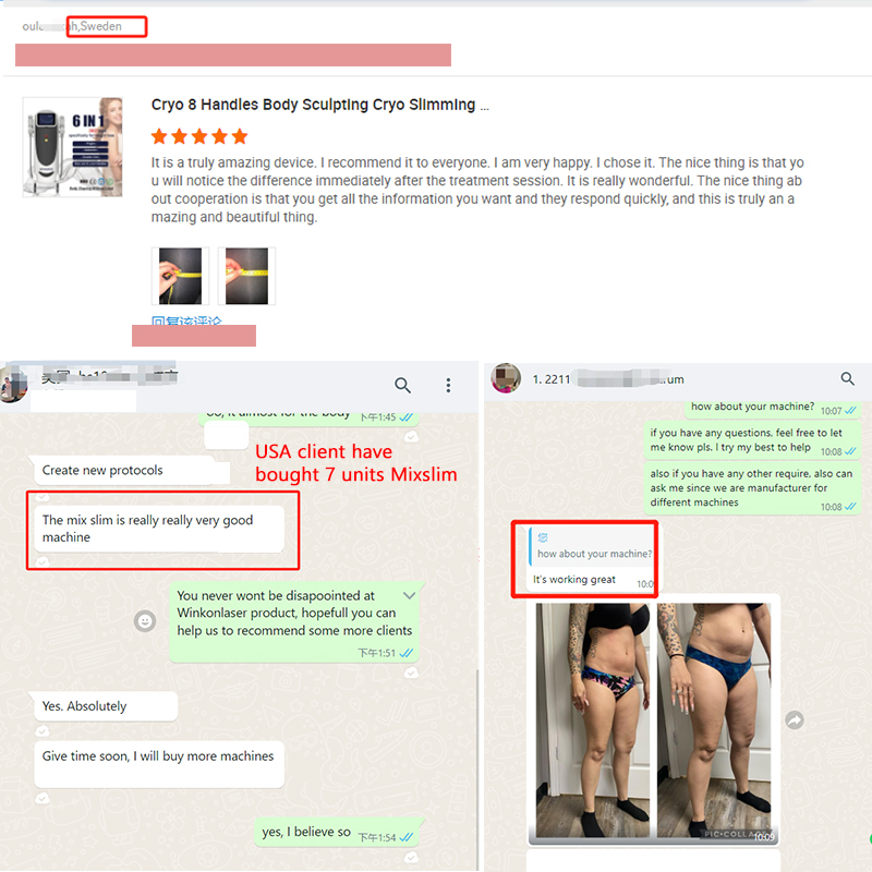 360 Cryo Body Slimming System fat freezing Weight Loss Cryolipolysis Machine Cellulite Reduction Double Chin Removal