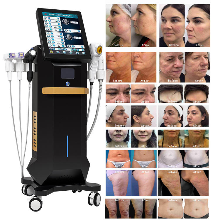 2024 Hifu Face Beauty Machine Face Lifting Skin Tightening Vertical 4 In 1 Hifu Latest Machine Skin Rejuvenation Face And Body