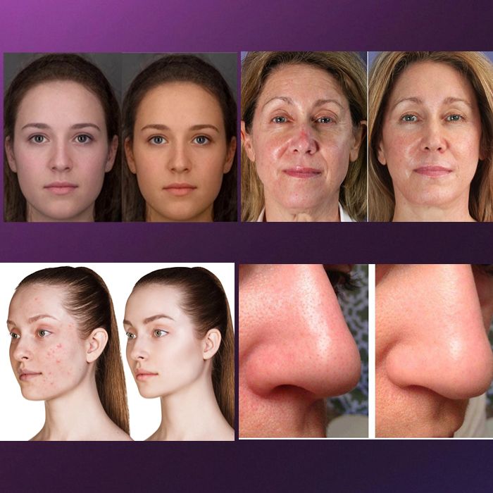 2024 Multifunctional Skin Care Beauty Machine Skin Analyzer Machine Facial