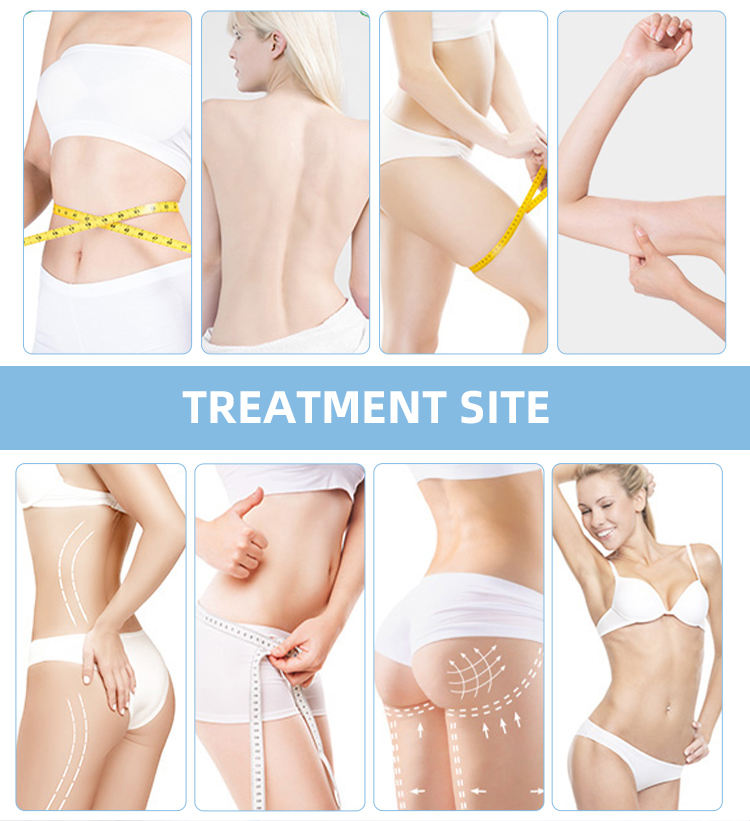 Most Effective TruSculpt ID RF Fat Dissolving Skin Firming Radio Frequency Monopolar RF Slimming Machine