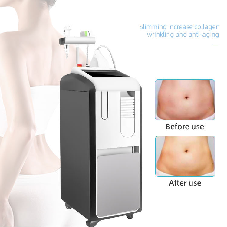 2024 Newest Cellulite Monopolar Fat Reduction Radio Frequency Trusculpt ID 3d body sculpting Slimming Face Lift Skin Tightening RF Machine For Salon