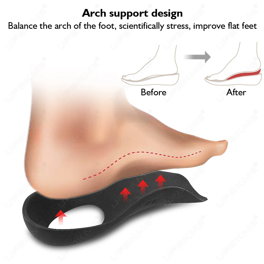 XO-Legs Flatfoot new Orthotics Large Size Insole For Flat Foot O-shaped Leg Arch Support Plantar Fasciitis Shoes Orthotic 2025 Pad Unisex
