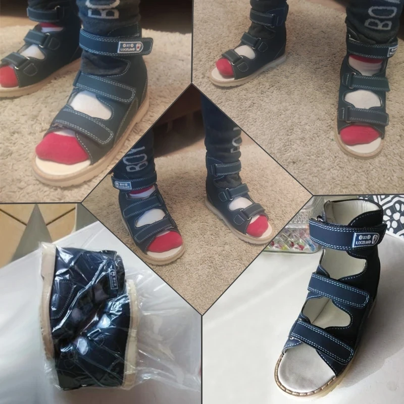 2025 Summer Children Orthopedic Sandal For Kid Baby Toddler Boys Medical Shoes Flatfeet With new Arch Support Insole
