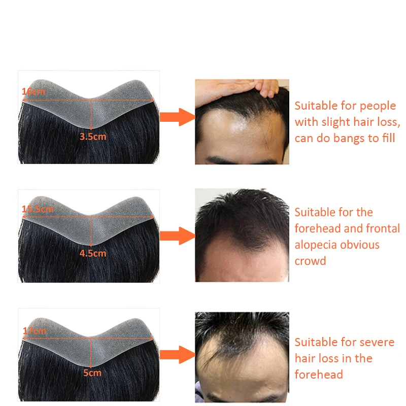 V Style Front Men Toupee Natural Hairline 100% Human Remy Indian High Quality Men Capillary Prosthesis Replacement Systems Unit