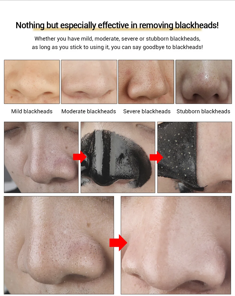 1PC Blackhead Remover Mask Nose Mask Nasal Strip Acne Peel Off Mask Shrink Pore Deep Cleansing Skin Care Peel Sticker Skin Care