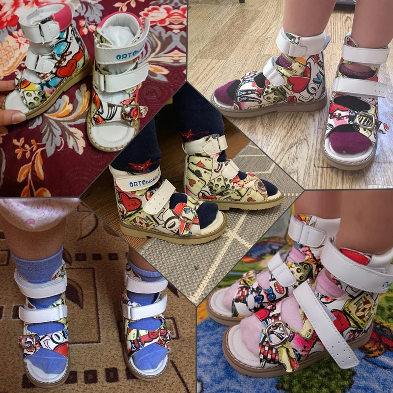 Ortoluckland Kid new Girls Sandals Orthopedic Leather 2025 Shoe For Children Summer Buckle Strap Arch Support Flatfeet Footwear 3 4 5Year