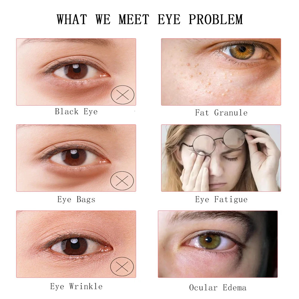 2 in 1 EMS Electric Face Eye Massager Remove Dark Circles Device Skin Lift Anti Age Wrinkle Care Tools 240430