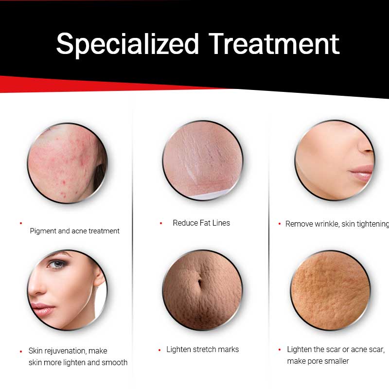 Fractional Rf Microneedle Beauty Machine Anti Aging Systems RF Skin Face Wrinkles Treatment Microneedling