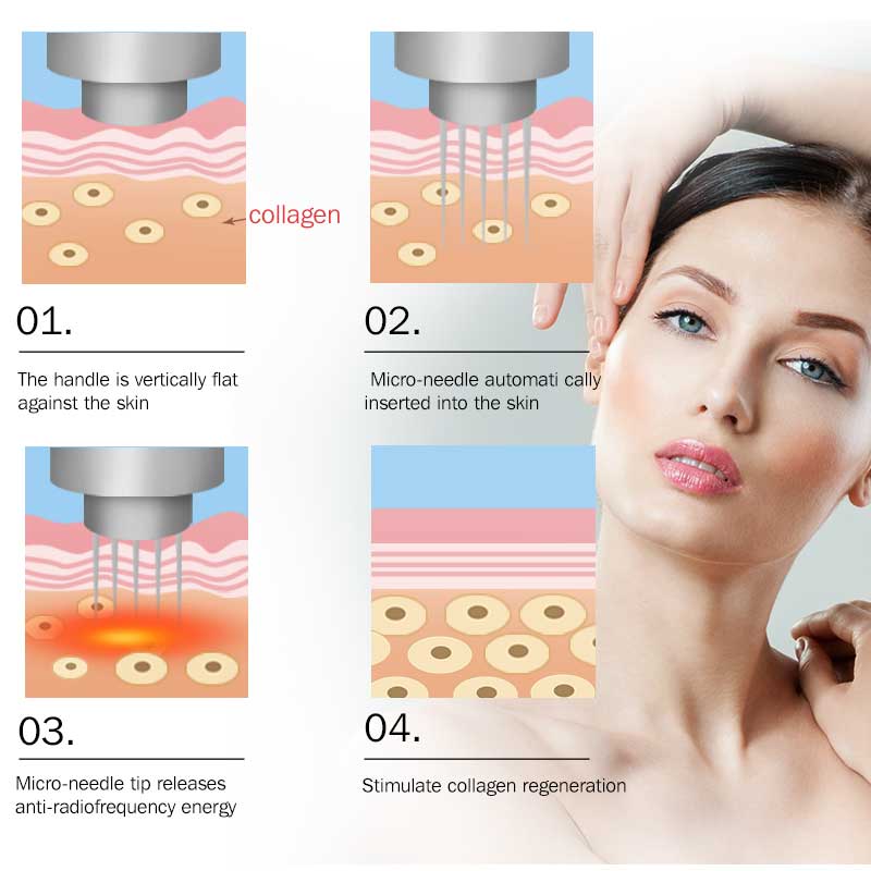 2024 Rf Microneedling Skin Tightening Equipment Anti-Aging Gold Fractional Microneedle Facial Beauty Machine TM50B