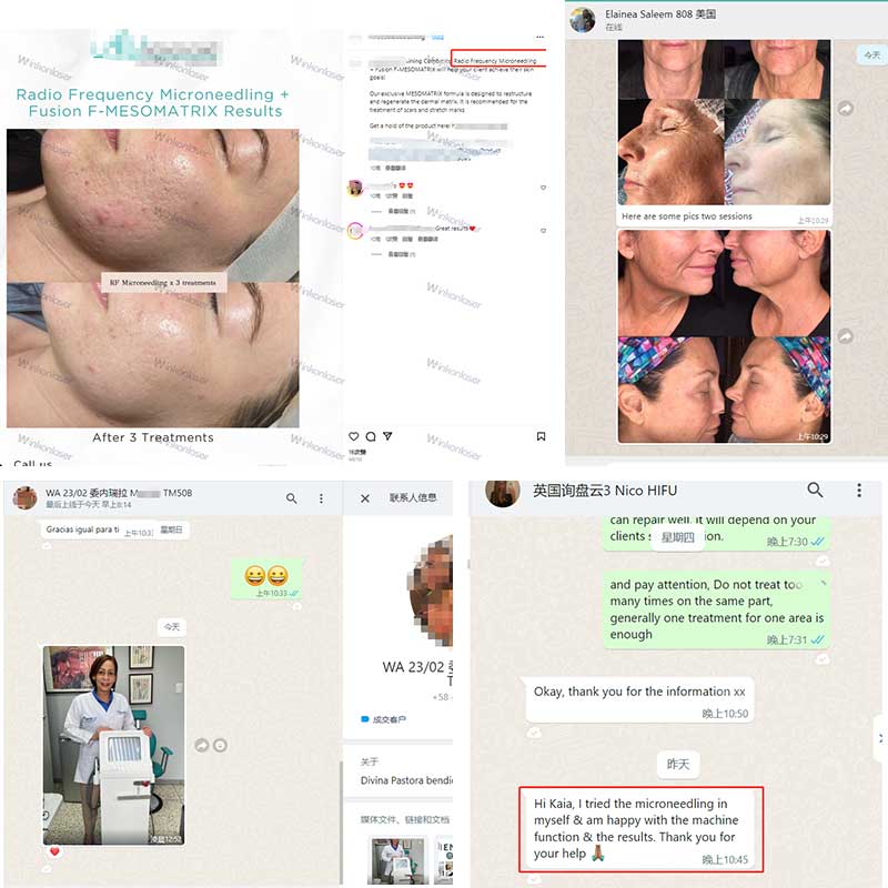 Fractional Rf Microneedle Beauty Machine Anti Aging Systems RF Skin Face Wrinkles Treatment Microneedling