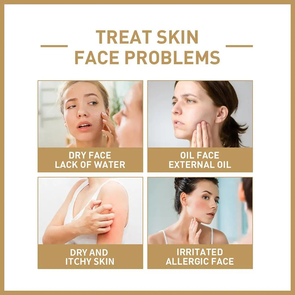 Rice Face Toner Moisturizing Water Brightening Lifting 150Ml Deep Cleanser For Young Glowy Korean Skin Care 240517