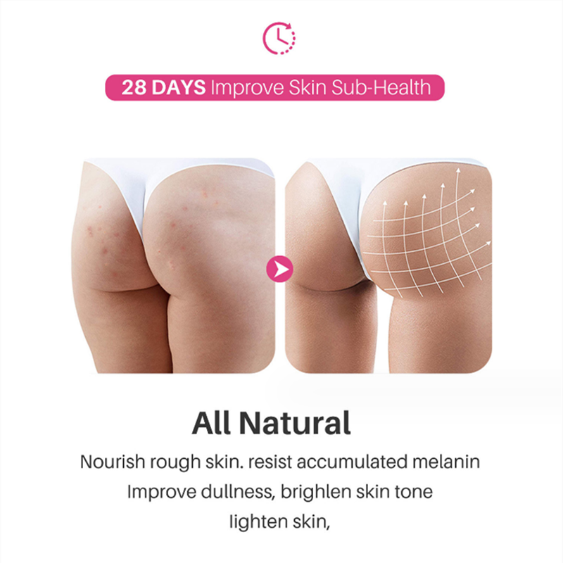 Butt Acne Clearing Spot Treatment Cream Clears Acne Pimples Zits Razor Bumps and Dark Spots for the Buttock Thigh Area