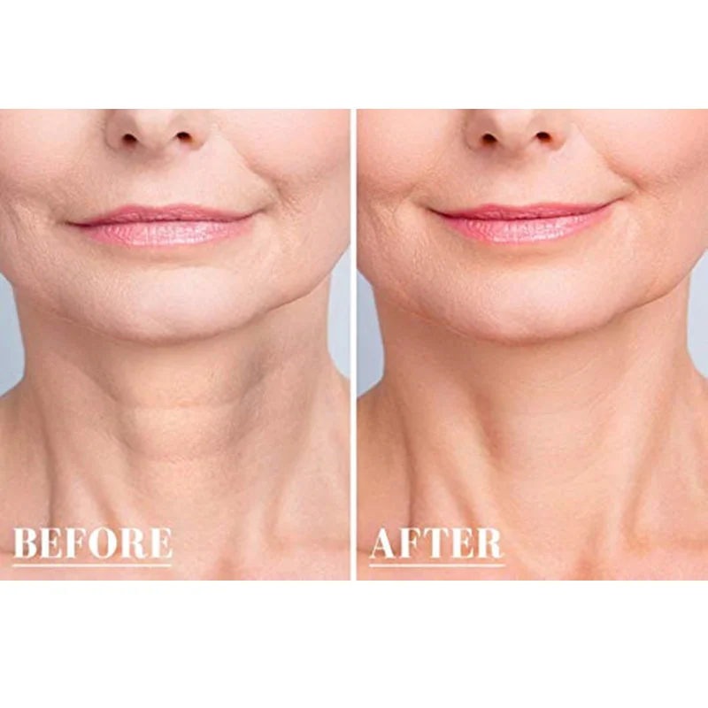 Reusable Silicone Wrinkle Removal Sticker Facial Lifting Strips Set Forehead Neck Line Remover Eye Patches Anti Aging Skin Pads