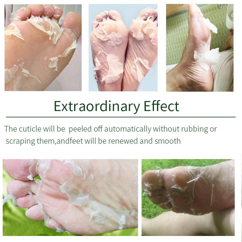 Lavender 2025 & VC Foot Peeling Mask Exfoliating Heels Calluses Remove Foot Patches Dead new Skin Remover Pedicure Socks Foot Care 1Pair