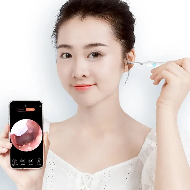 4.0MM Visible Ear Wax Cleaner Endoscope With 800W Pixel Otoscop Camera 2025 Ear Wax new Removal WiFi HD Ear Care Electircl Earpick Remove