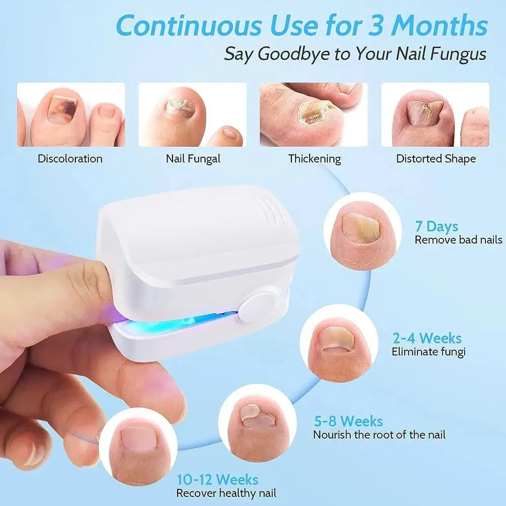30ml Fungal Nail Treatment Essence Oil Nail Fungus Laser Device Repair Toenail Fingernail Treatment Onychomycosis with Mushrooms
