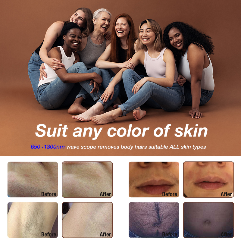 Ice Painless Laser Permanent Hair Remover LED Laser Hair Removal Machine 650~1300nm laser Diode Epilation Definitive