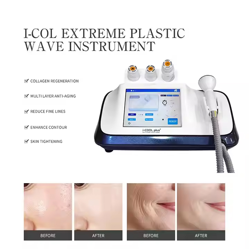 Body Contouring Smas Treatment Vmax Ultrasound Facial Y Corporal Radiofrecuencia Skin Firmness Machine