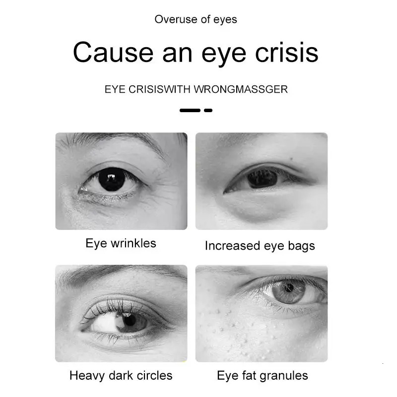 EMS Electric Undey Eye Massager for Women Home Use Beauty Product with Red Light Therapy for Eye Massage 241206