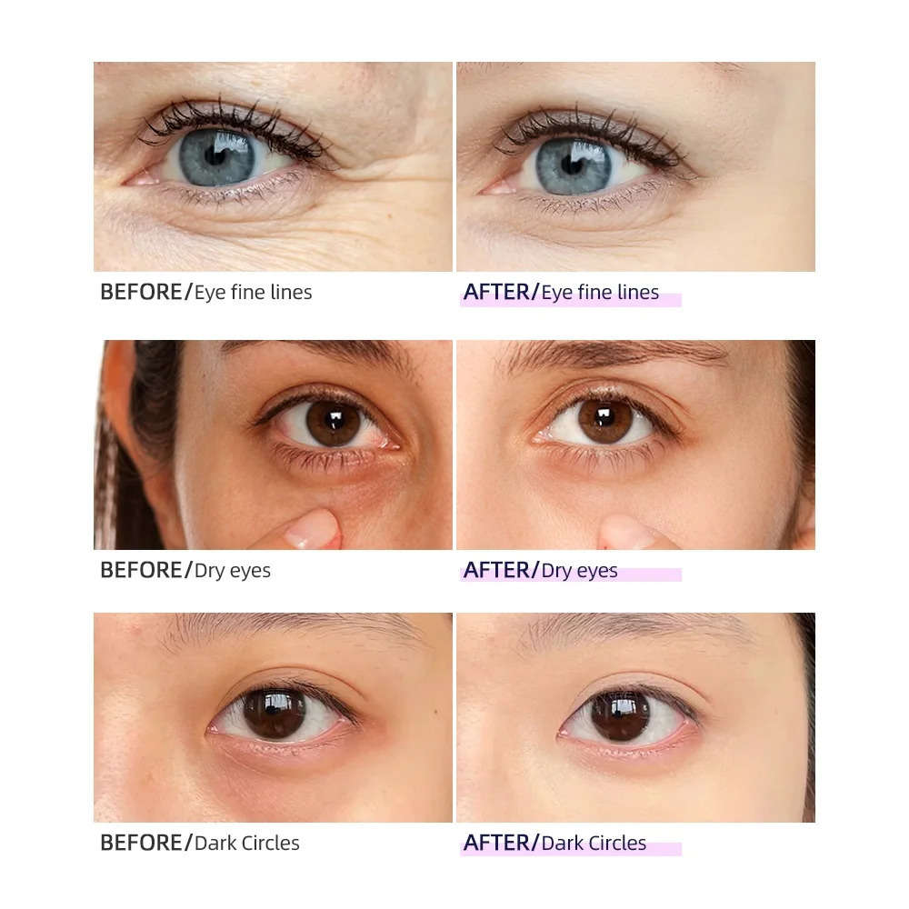 Rechargeable Eye Massager Lighten Dark Circles Aging Eye Care Beauty Tool Massage 241206