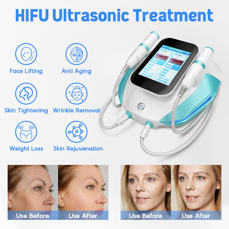 Exclusive 2 Handles HIFU Skin Rejuvenation Face Contouring RF Body Shaping Wrinkle Remover SMAS Anti-aging Beauty Machine High Intensity Focused Ultra