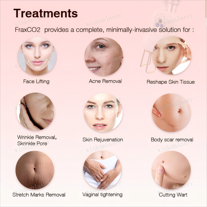 70W CO2 Fractional RF laser face resurfacing machine skin rejuvenation vaginal tightening 3IN1 beauty equipment