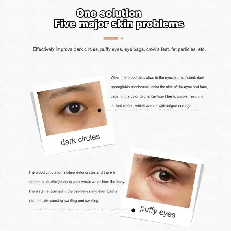 4 in 1 Electric Facial Massager Micro Vibration Eye Beauty Instrument for Relax Eye Dark Circles Eye Bags Wrinkles Puffiness W241213
