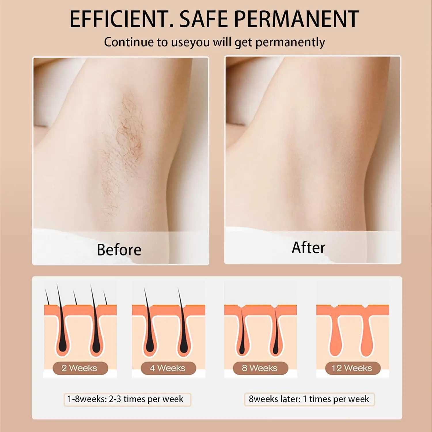 Hot Sale 999999 Flashes IPL Hair Removal Laser Epilator Women Photo Facial Hair Remover Body Epilator Laser Machine 04XJ241213