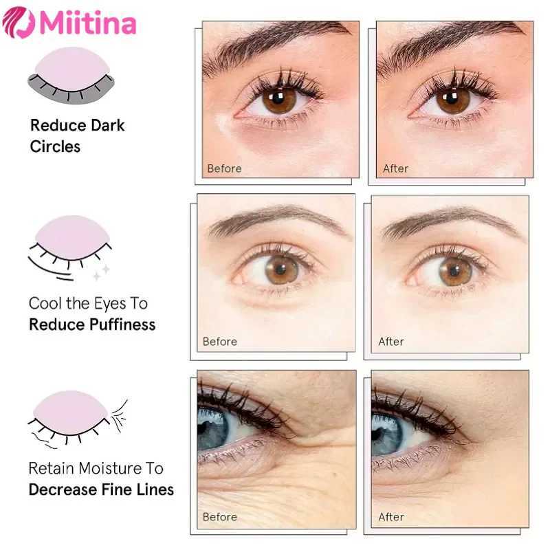 Miitina LED Microcurrent Pulse Eye Massager Relieves Eye Fatigue Fades Dark Circles Wrinkles Heat TreatmentEye Beauty Device W241213