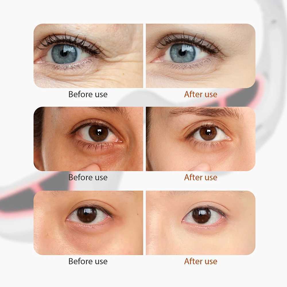 Eye Massage Relieves Eye Fatigue Eyes Massage Glasses Eye Fatigue Relief Massager Under Eye Massage Machine W241213